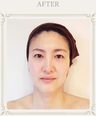 After